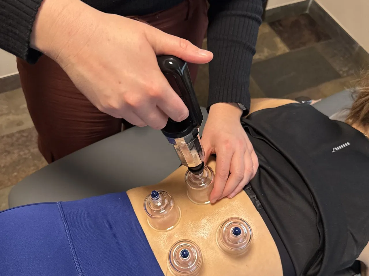 Margaux plaatst cupping-bekers op de onderrug van een patiënt