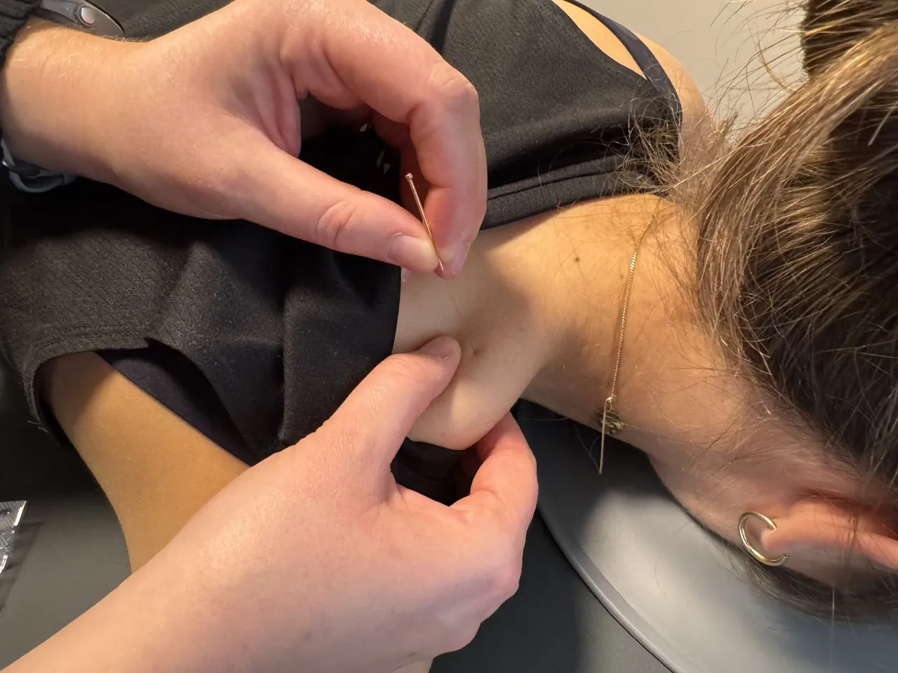 Margaux plaatst een fijne naald in de nek- en schouderspieren